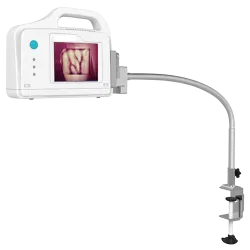 Vein Illuminator - Vein Illuminator KVI-A100